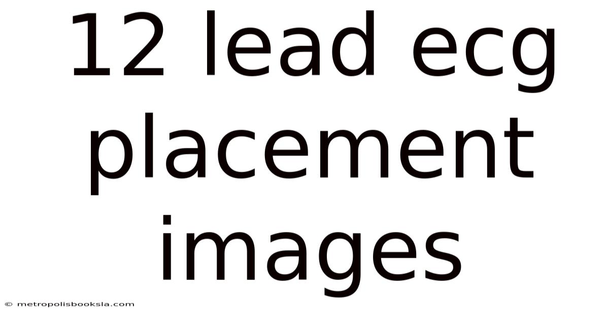 12 Lead Ecg Placement Images