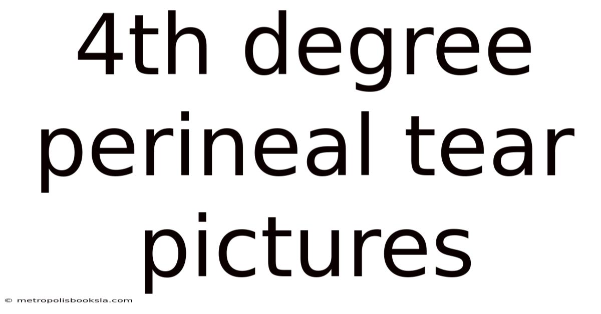 4th Degree Perineal Tear Pictures