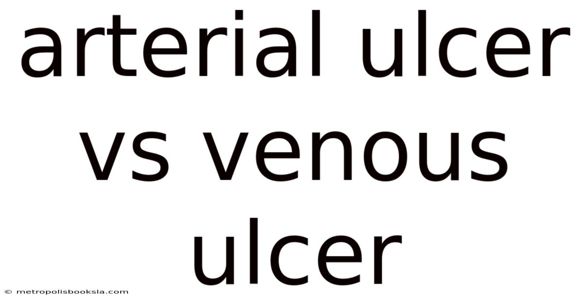 Arterial Ulcer Vs Venous Ulcer