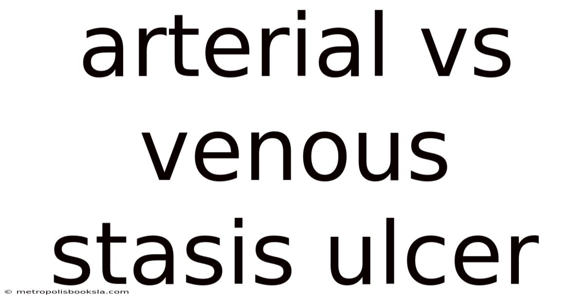Arterial Vs Venous Stasis Ulcer