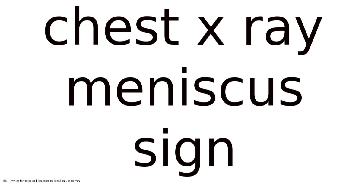 Chest X Ray Meniscus Sign