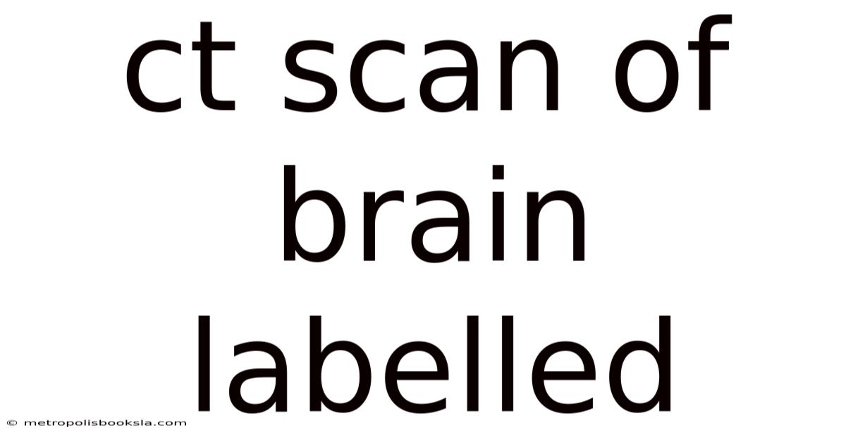 Ct Scan Of Brain Labelled