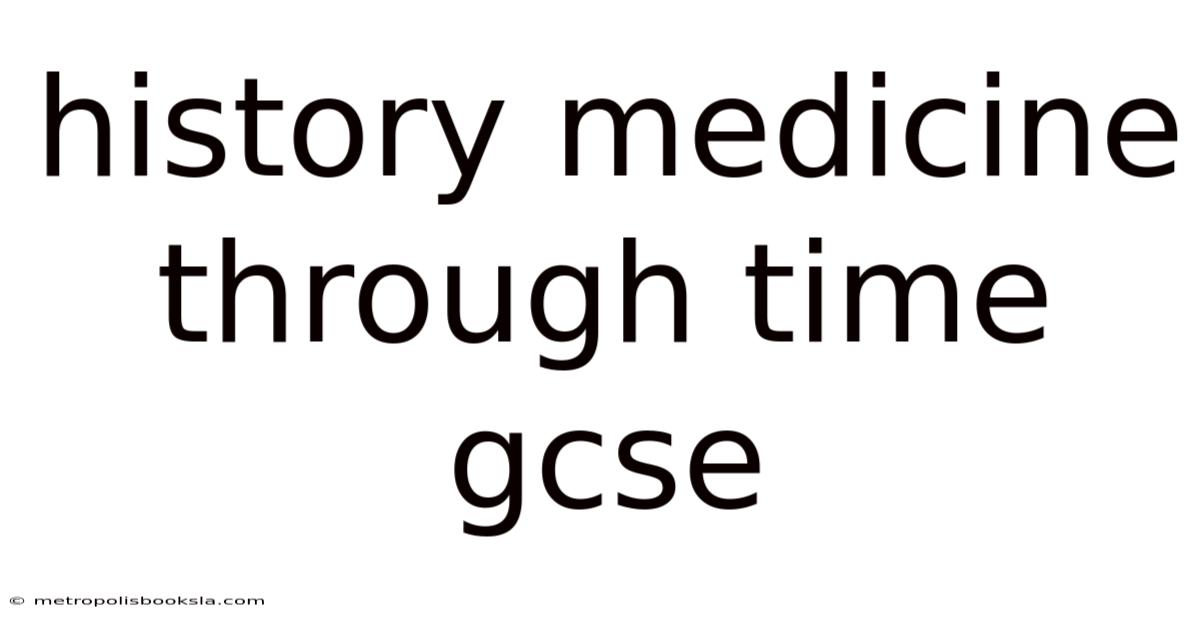 History Medicine Through Time Gcse