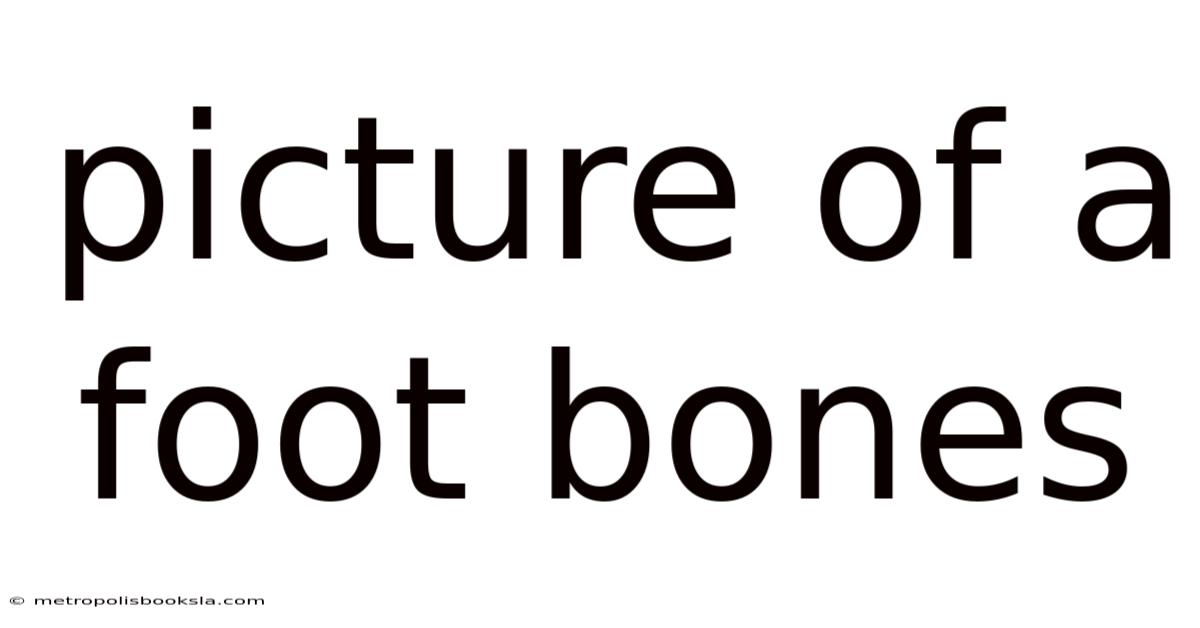 Picture Of A Foot Bones