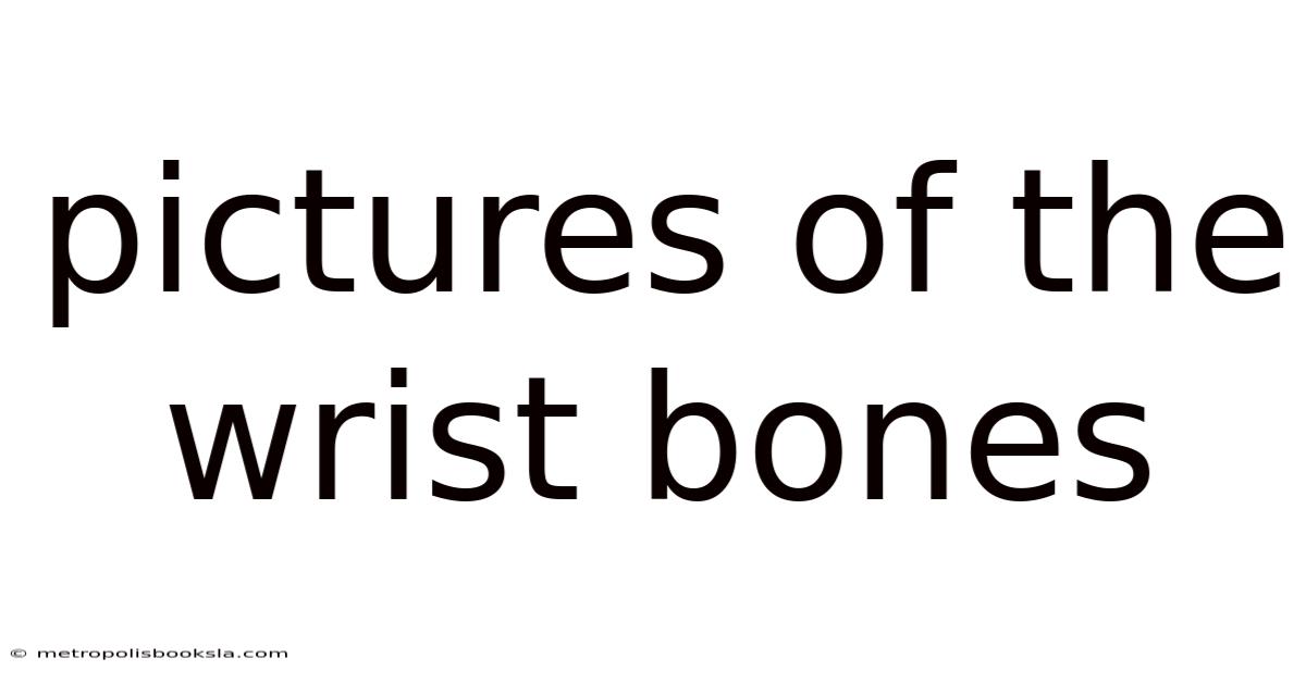 Pictures Of The Wrist Bones
