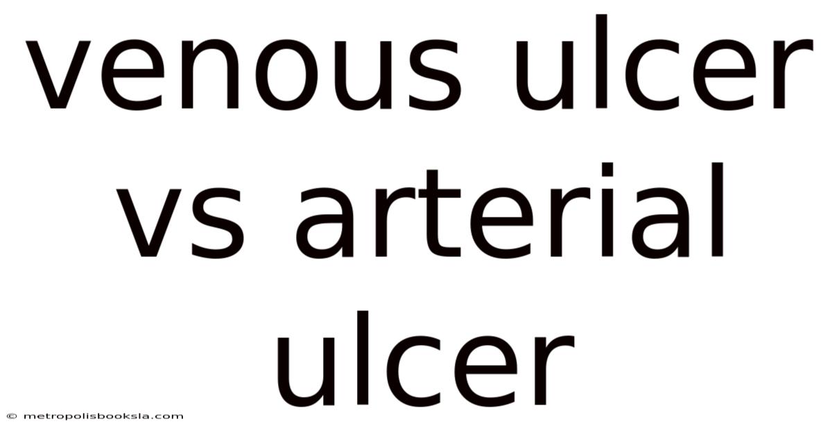 Venous Ulcer Vs Arterial Ulcer