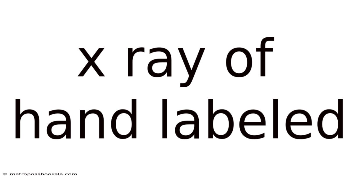 X Ray Of Hand Labeled